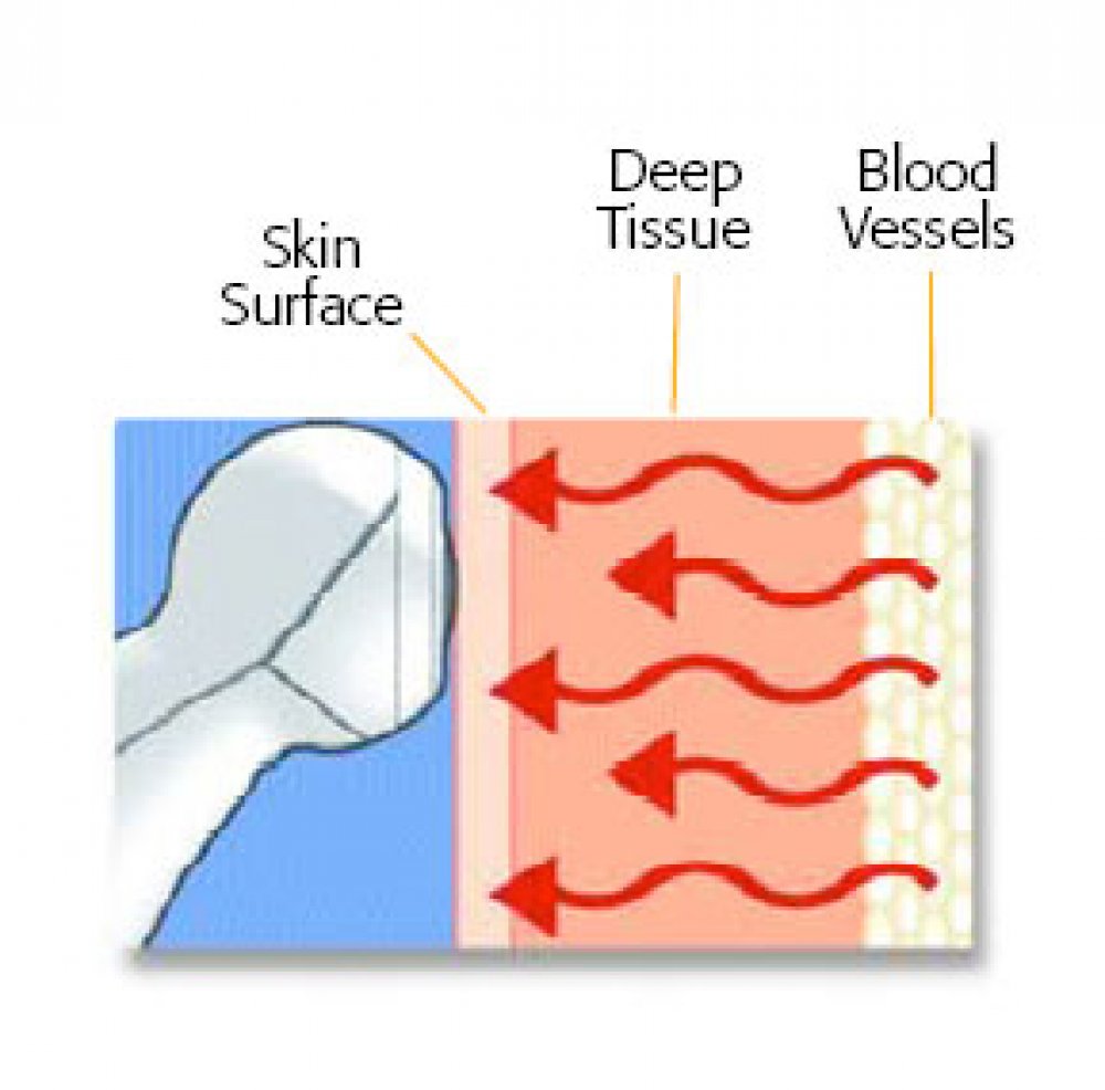 ADC Adtemp™ 427- 6 Second Conductive Thermometer, 12/pkg