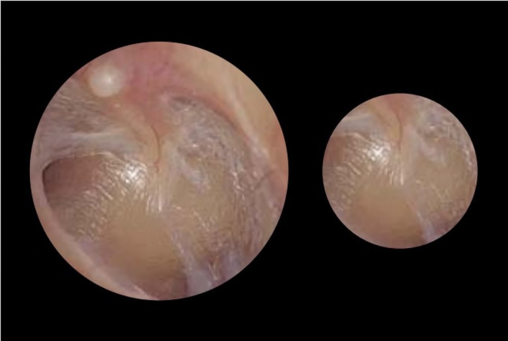 ADC Adstation™ 5610-38W- 3.5V Modular Diagnostix Wall System with e-sphyg 3, Standard Otoscope, Coax Ophth, Dispenser, Thermometer, W.Board